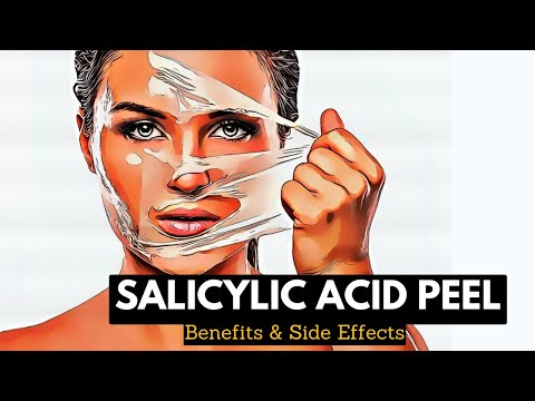 All About Allergy Shots