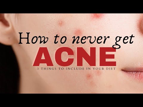 How To Never Get Acne Again