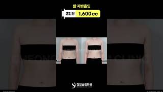 3개월차 되니까 팔라인 확실히 정리된 느낌 💪