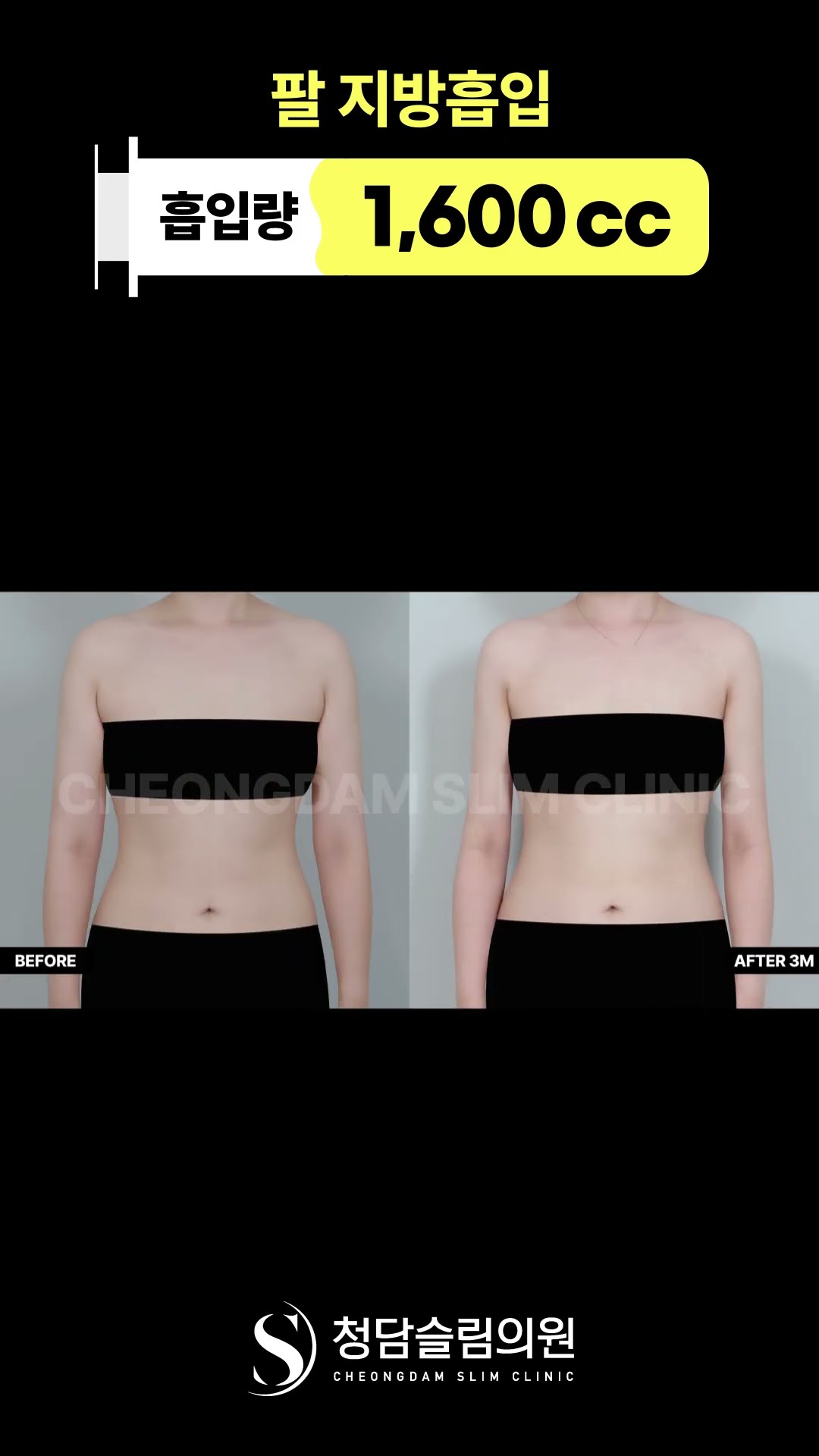 3개월차 되니까 팔라인 확실히 정리된 느낌 💪