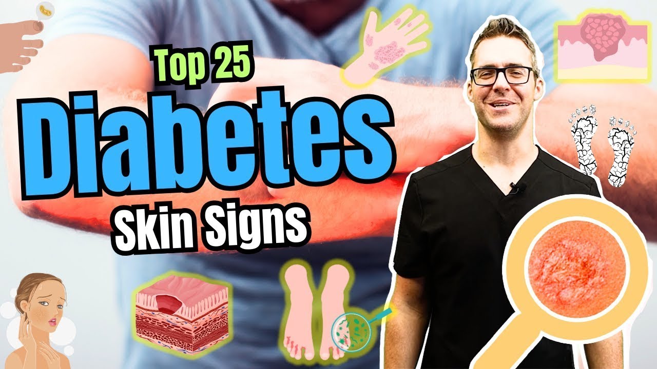 What are the symptoms of type 2 diabetes [Early Skin Signs]