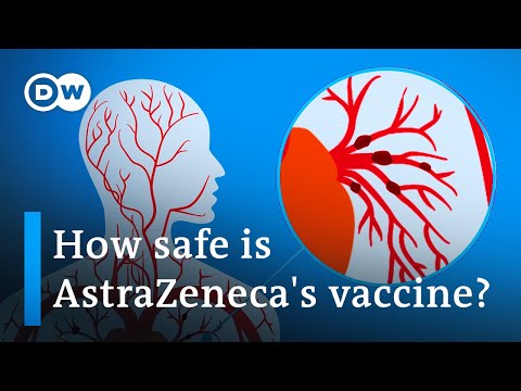 阿斯利康COVID疫苗會導致血栓嗎？| 阿斯利康COVID疫苗是否會導致血栓？ (Does the AstraZeneca COVID vaccine cause blood clots? | DW News)