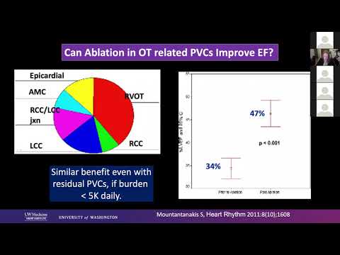 7 10 20 Robinson Mapping and Ablation of PVCs pt  1