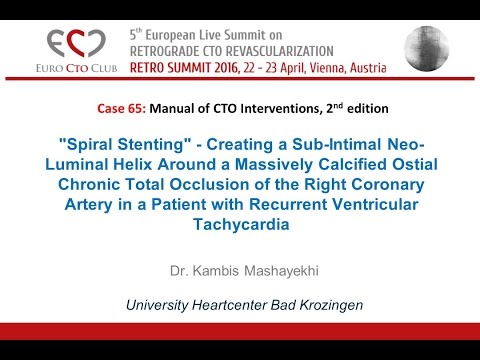 Case 65: Manual of CTO Interventions - Severely calcified RCA CTO