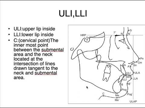 Cephalometric landmark in orthodontics(4)
