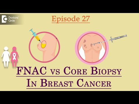 FNAC vs CORE BIOPSY for Breast-What is the difference?-Dr.Sandeep Nayak| Samrohana | Doctors' Circle