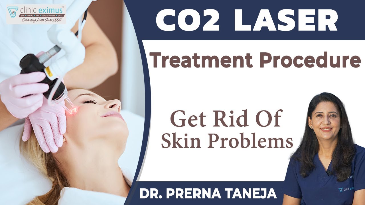 Laser Treatments