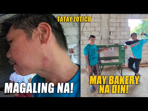 HOW'S TATAY ZOTICO AFTER MAOPERAHAN SA LEEG? (Life Changing!)