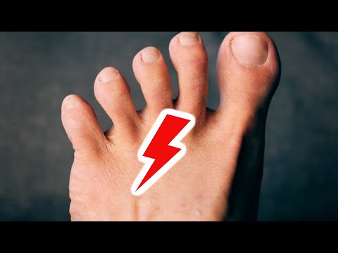 Morton Neurom: URSACHEN und LÖSUNGEN