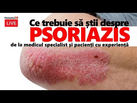 Unguent valusal pentru osteochondroză