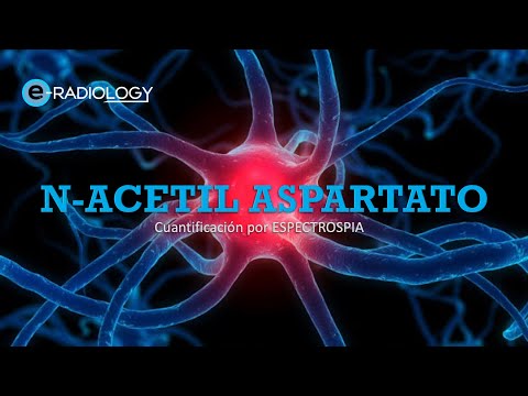 Espectroscopia de protón por resonancia magnética - 3º parte: el N-acetil aspartato