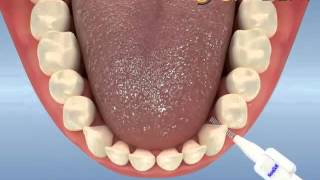 ara yüz fırçası kullanımı