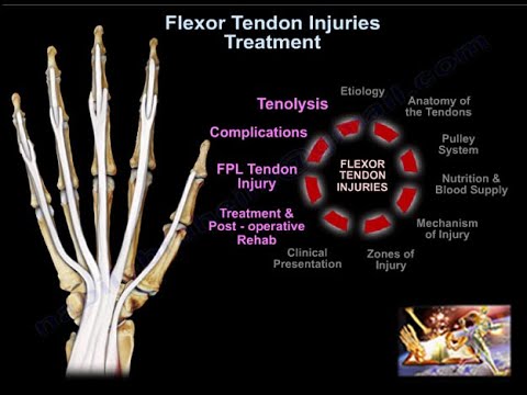 Flexor Tendon Injuries Treatment - Everything You Need To Know - Dr. Nabil Ebraheim