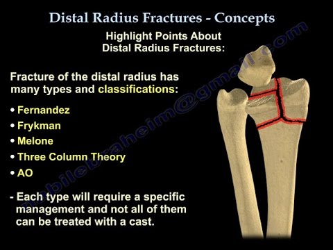 Distal Radius Fractures - Everything You Need To Know - Dr. Nabil Ebraheim