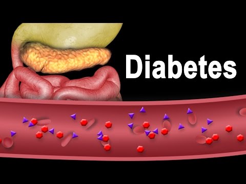 Diabetes 2 fajta népszerű kezelési módszerek receptek