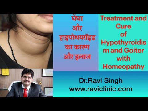 Treatment and Cure of Hypothyroidism and Goiter with Homeopathy