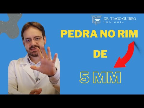 Pedra no rim de 5mm pode ou não sair sozinha?