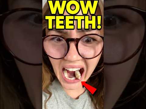 What The Dentist Did Shocked Everyone 😳