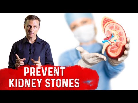 An APPLE a Day Will NOT Let Your Weight Go Away – Dr Berg