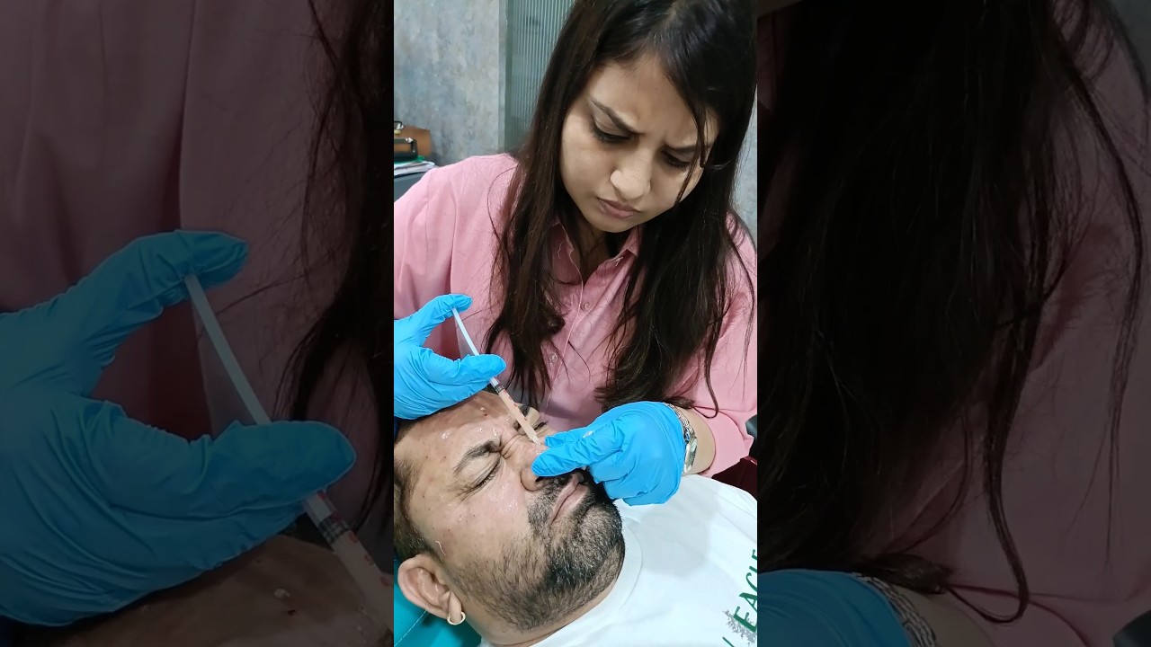 Botox Injections  #skincare #laserskinrejuvenation #lasertreatment