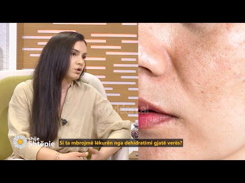 Dermatologia: Hidratues dhe SPF çdo ditë të vitit, vitaminën C mos e ndani gjatë verës