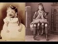 Цирк уродов: истории и трагедии цирковых уродцев, страшные страницы истории 