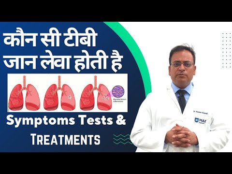 कौन सी टीबीजन लेवा होती है Symptoms Tests  Treatments #tb #tuberculosis #savelungcenter
