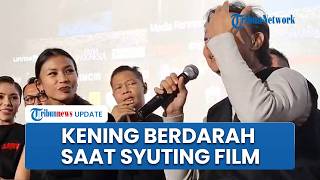 Cerita Verdi Solaiman Keningnya Berdarah karena Tendangan Shareefa Daanish saat Syuting Film 'Lift'