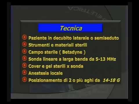 Stecche per larticolazione della spalla Ð ± оР»NOE D² ÑÐμÐμ Ð¿Ñ Ñ € Ð ° вР° Ð¿Ñ € D нР° кл онÐμ гоР»Ð¾Ð²Ñ <
