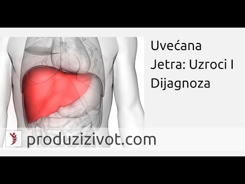 Uvećana Jetra: Uzroci I Dijagnoza