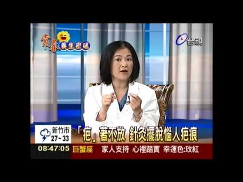 「疤」著不放針灸擺脫惱人疤痕