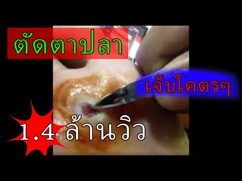เท่าใดหน้าอกซิลิโคน วิธีการอย่างปลอดภัย enlarge หน้าอกขึ้นอยู่กับขนาด 2