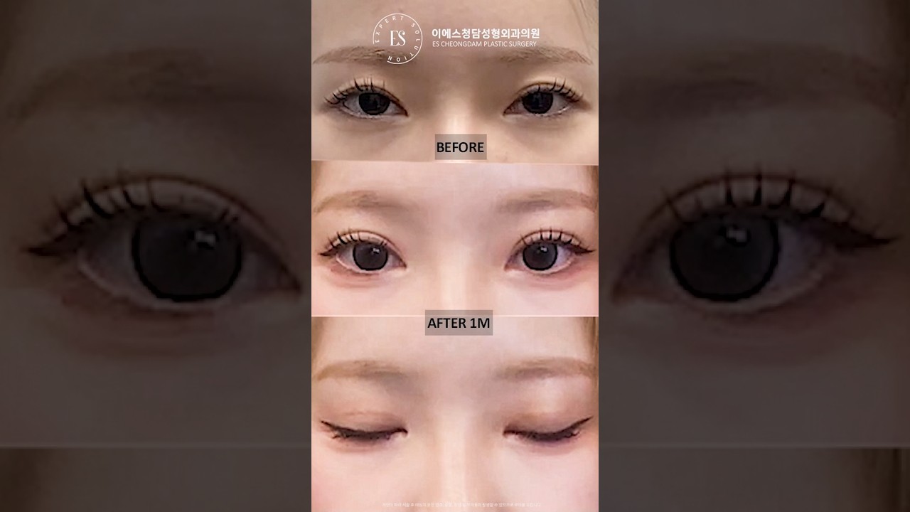 이에스 유튜브