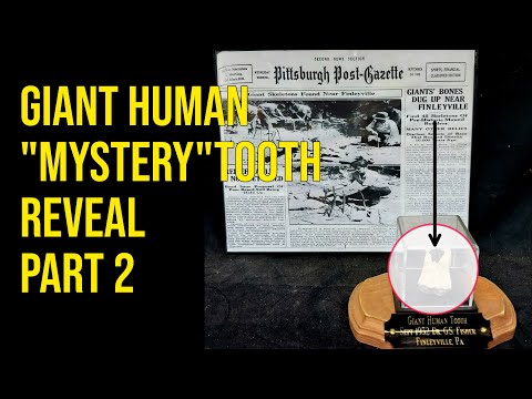 Giant Human "Mystery" Tooth - The Opening of the Package LIVE - Part 2