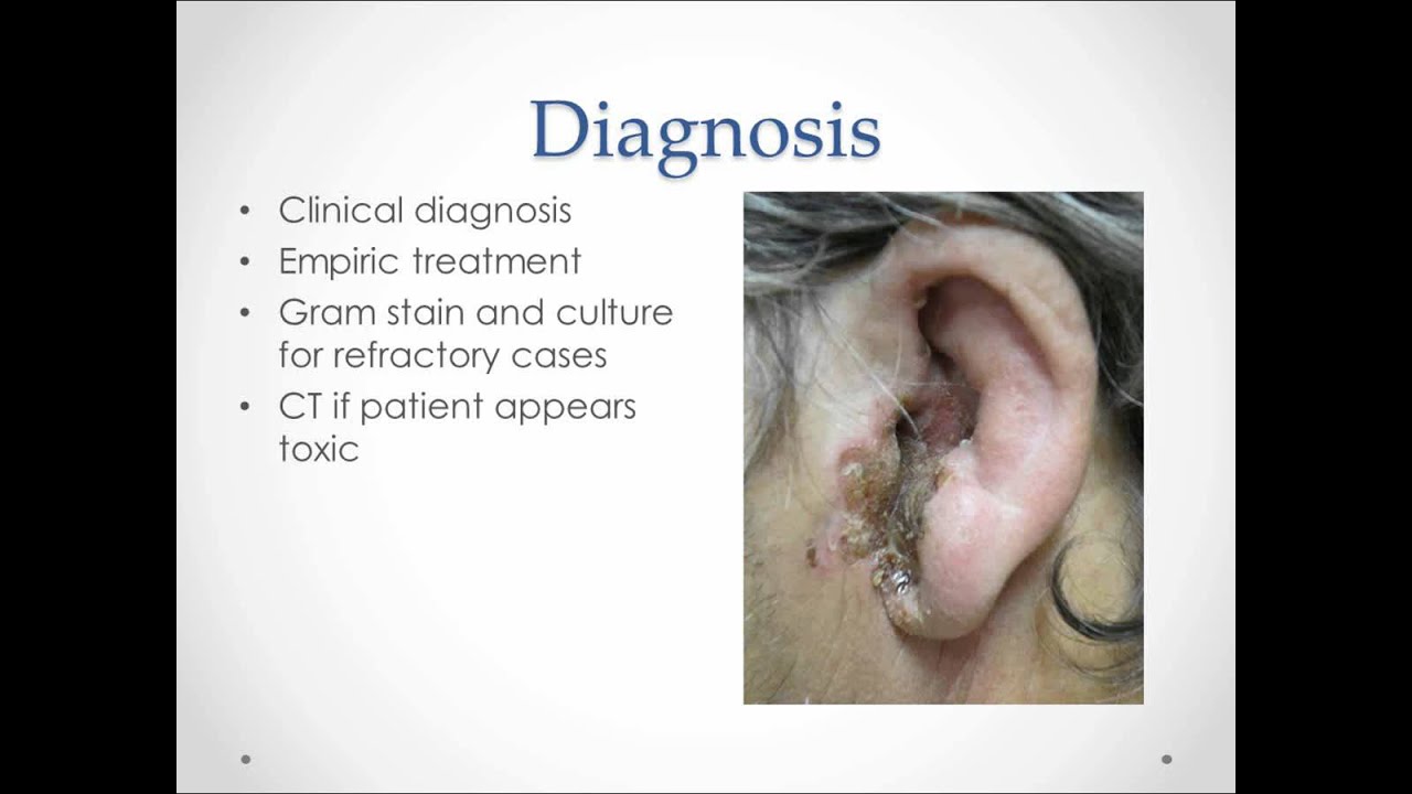 Otitis Externa - USMLE Step 2 Review - YouTube