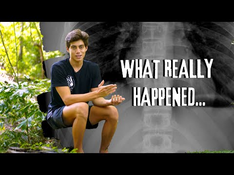 The story of how I fractured 5 ribs mountain biking...