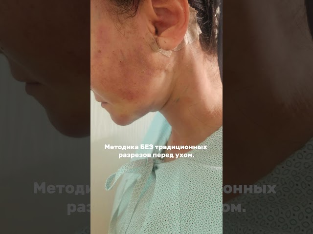 РУБЕЦ ЗА УХОМ и естественное омоложение лица