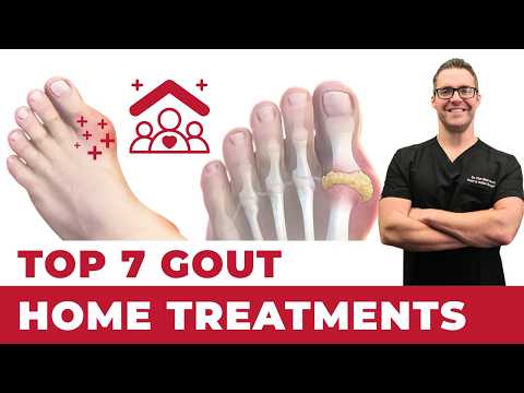 🔥Top 7 Gout Foot & Big Toe HOME Treatments [+1 BIG SECRET]