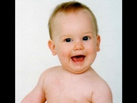 La psoriasis en las ciencias La foto de la eccema sobre el pope