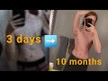 ASMR For Trans Awareness Week Top Surgery Update