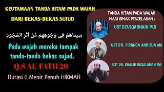 Download lagu JIDAT HITAM, SEBAGAI TANDA TAQWA, UST DZULQARNAIN M.S, DR. FIRANDA ANDIRJA, DR. KHALID BASALAMAH mp3