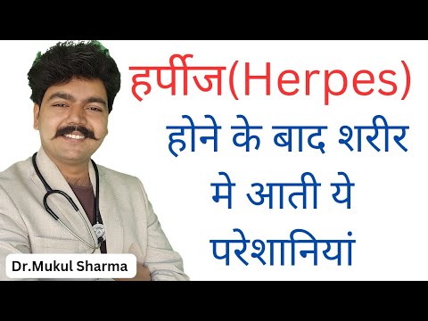 These problems arise in the body after contracting herpes! Herpes Simplex Virus in Hindi