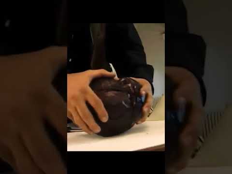 CABBAGE NETWORK (Enhanced 4K)