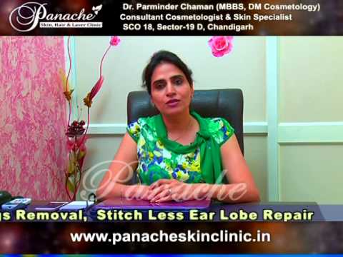 #bestlaserhairremoval IN CHANDIGARH