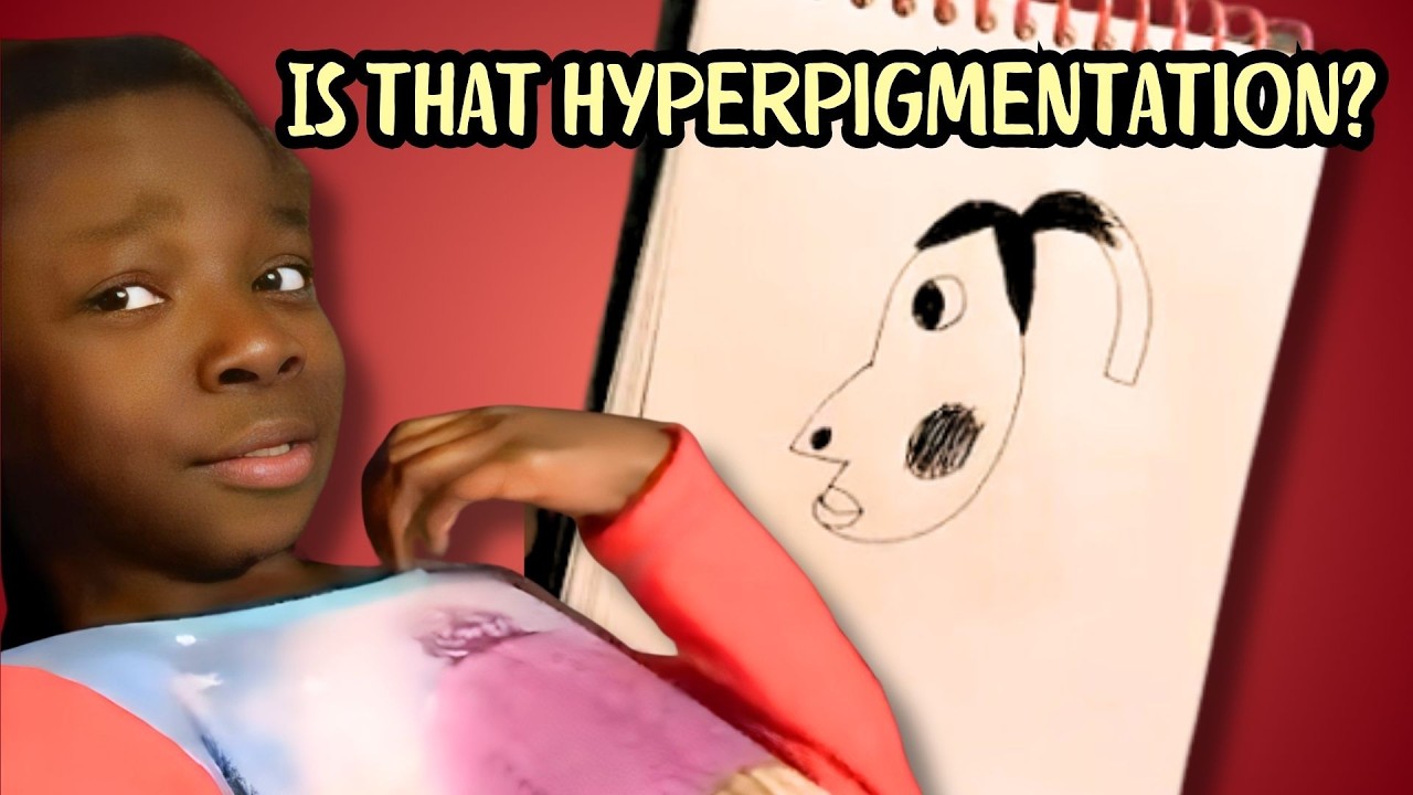 Understanding the Hyperpigmentation Drawing Meme