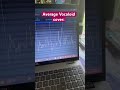 Perfectly Normal Vocaloid Tuning Vocaloid Cover Shortvideo