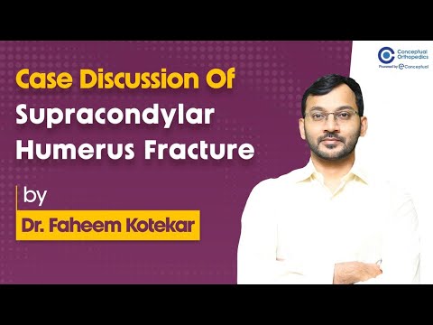 Supracondylar Humerus Fractures | Dr. faheem kotekar | Orthopedic Residency | Conceptual Orthopedic