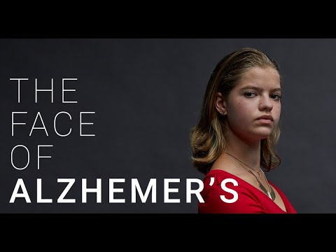 The Face of Alzheimer's - 250,000 Kids