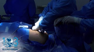 Manga gástrica. Crónica de una hora en el quirófano