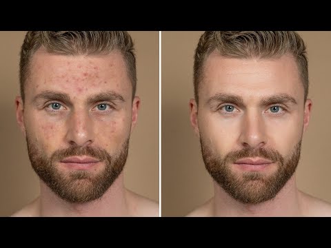 How to get clear skin ● Beginner skin care tips for men